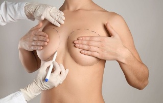 methods of breast augmentation with surgery