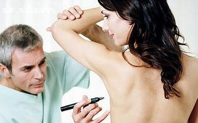 Surgical method of breast addition