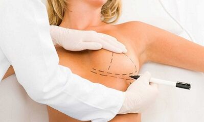 How to increase implants cerebrals