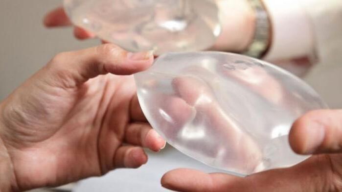 Breast endoprostetics