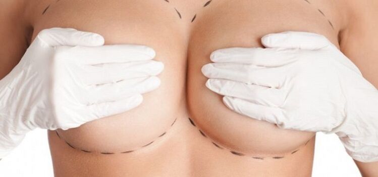 surgical breast augmentation
